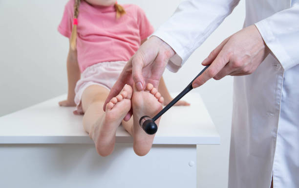 um médico, um neurologista, verifica o reflexo babinsky na sola do pé. martelo neurológico. neuralgia infantil - neuropathologist - fotografias e filmes do acervo
