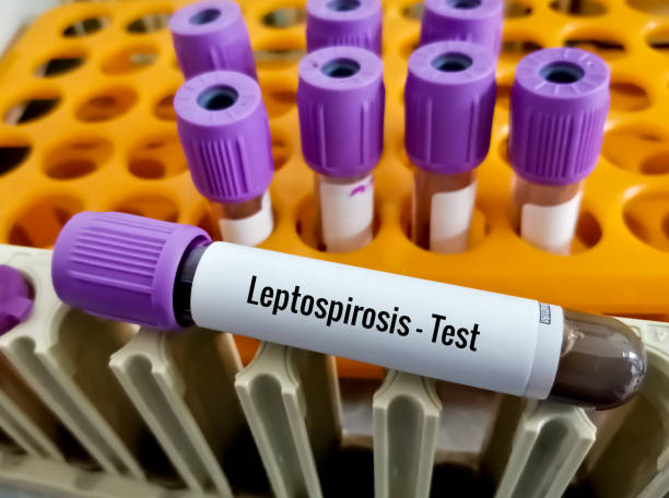 Blood sample tube for Leptospirosis test at laboratory Blood sample tube for Leptospirosis test at laboratory leptospira stock pictures, royalty-free photos & images