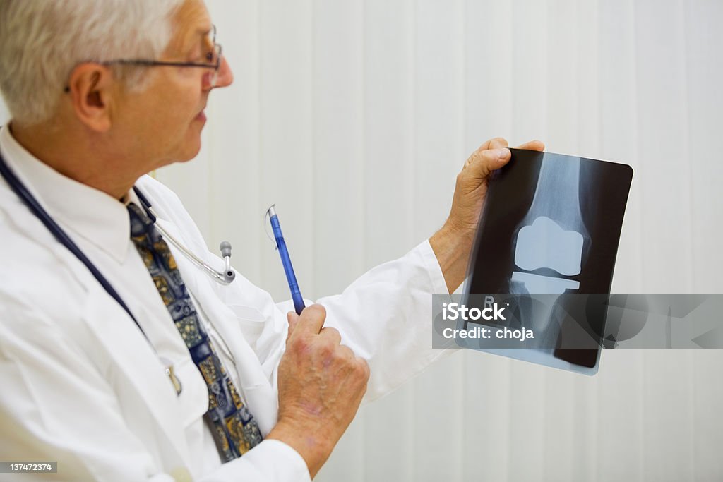Lekarz bada Zdjęcie rentgenowskie Endoproteza stawu kolanowego - Zbiór zdjęć royalty-free (Sprzęt protetyczny)