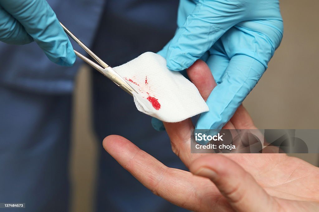 Nurse is changing bandage to a wounded patient's finger At the doctors office Wound Stock Photo