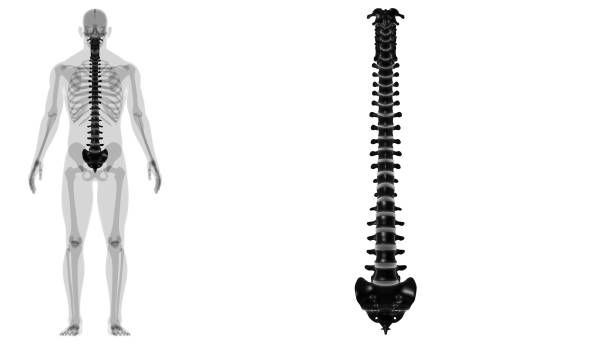 Kyphosis pathology with man model from lateral view 3D rendering illustration with copy space. Human anatomy, spinal disorders or deformity, curvature of the spine, backbone pathology, medical concepts.