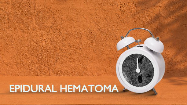 istock A white alarm clock compositing with a brian epidural hematoma image. 1375573769