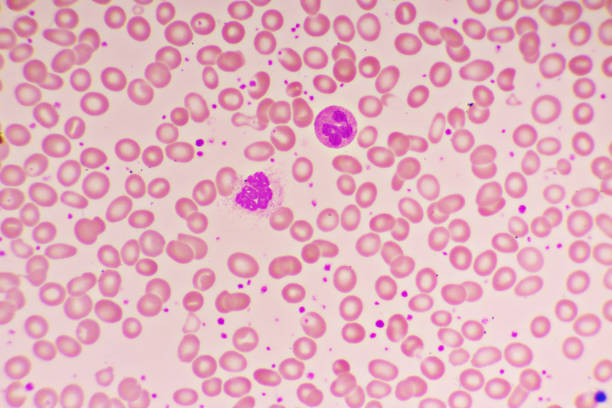 血小板症の血塗り - blood cell blood red blood cell microscope ストックフォトと画像