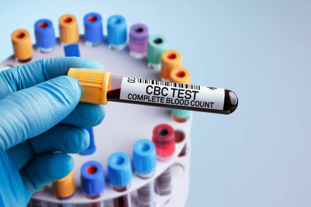 Blood sample of patient for analysis of CBC Complete Blood Count test in laboratory stock photo