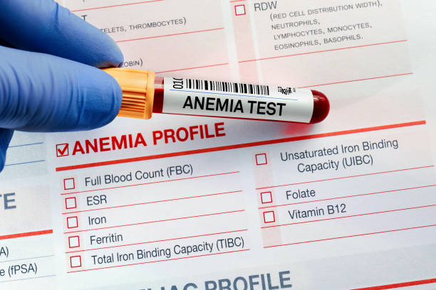 medico in possesso di esame della provetta di sangue con modulo di richiesta per il test di anemia - blood red blood cell blood cell blood sample foto e immagini stock