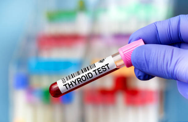 Blood tube test  for Thyroid test stock photo
