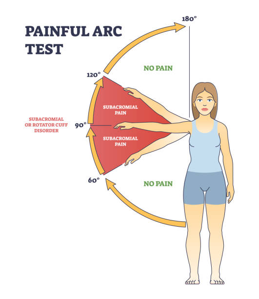 ilustraciones, imágenes clip art, dibujos animados e iconos de stock de prueba de arco doloroso y síndrome de fisioterapia diagrama de esquema de diagnóstico médico - rotator cuff