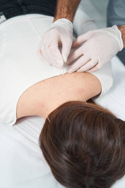 istock Female on acupuncture session to relax muscles 1378047261