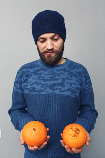 el hombre barbudo hace muecas y muestra naranjas normales y feas, concepto de hemorroides o enfermedades proctológicas. photo