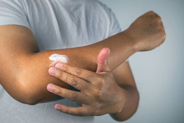 blessure au coude causée par le tennis et le golf. l’homme utilise de la crème médicinale pour frotter son bras. connaissances en soins de santé. plan rapproché moyen. - rubbing photos et images de collection