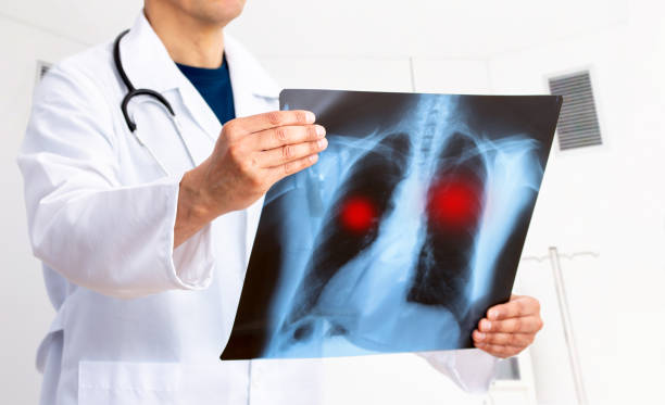 врач проверил рентгеновский снимок - x ray x ray image chest human lung стоковые фото и изображения