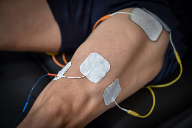 dispositivo stimolatore muscolare con elettrodi applicati al quadricipite da un fisioterapista professionista - electrode foto e immagini stock