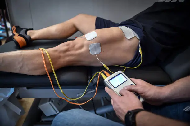 Photo of Muscle stimulator device with electrodes applied to quadriceps by a professional physiotherapist