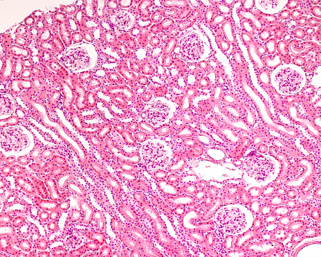 Low magnification micrograph of the renal cortex. The presence of renal corpuscles stands out, in which, even at this magnification, the uriniferous or Bowman space located around the glomerular vascular tuft can be clearly distinguished. The space between the glomeruli is occupied by sections of convoluted tubes. Crossing the image obliquely, two groups of tubules sectioned longitudinally are observed. They are the medullary rays, also called columns or pyramids of Ferrein. They contain collecting ducts and straight portions of the proximal and distal convoluted tubules.