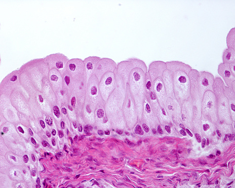 In the urinary tract, from the renal pelvis to the urethra, there is a special type of epithelium: it is the transitional epithelium, also called urothelium because it is exclusive to this tract. It is an epithelium with a stratified appearance, with cells whose nuclei are arranged in several layers. However, it has been shown that superficial cells emit processes that reach the basal layer. The surface cells are large and often shaped like an inverted club or pear, as can be seen in the micrograph. Also typical is the domed, globular appearance of the luminal surface of epithelial cells.