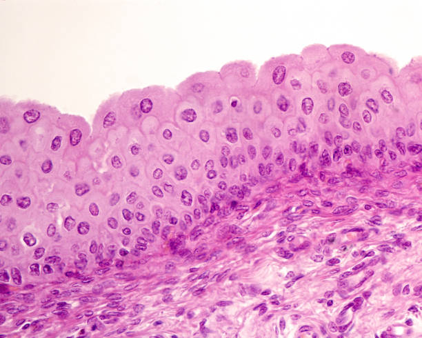 Urinary bladder. Epithelium In the urinary tract there is a type of epithelium, the transitional epithelium or urothelium, which is exclusive to this region of the body. It is an epithelium with a stratified appearance, that is, whose cells are arranged in several layers from the base to the light. Above the basal layer, a variable number of cell layers are located depending on the state of distension of the organ, which can be very well evidenced in the urinary bladder. The image pertains to an empty bladder and shows 6 to 7 layers of nuclei, which are reduced to 2-3 in a full bladder. Finally, it is also characteristic of the transitional epithelium that the superficial cells and, sometimes, also in the intermediate layers, are binucleated or show very large nuclei, corresponding to polyploid nuclei. urothelium stock pictures, royalty-free photos & images