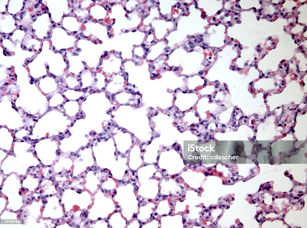 Tessuto polmonare sezione - Foto stock royalty-free di Alveolo