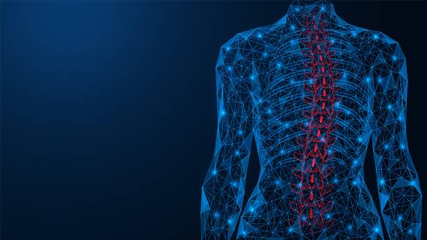 척추측만증, 척추의 곡률. - human spine digitally generated image illness healthcare and medicine stock illustrations