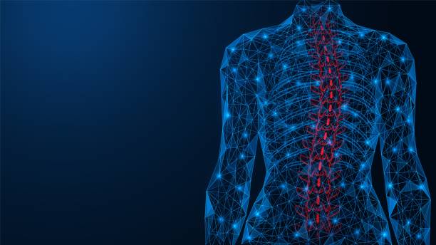 Scoliosis, curvature of the spine. Scoliosis, curvature of the spine. Incorrect deformation of the human back. Polygonal design of interconnected lines and points. Blue background. deformed stock illustrations