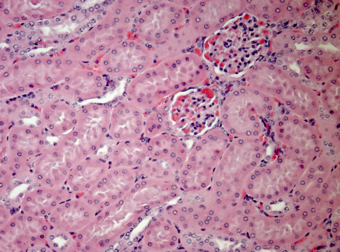 Histological section of kidney tissue taken with microscope. Nuclei stain blue and cell cytoplasm is pink. Scattered red blood cells. Mostly tubules with two glomeruli present. Hematoxylin and Eosin (H&E) stain. More tissue sections: