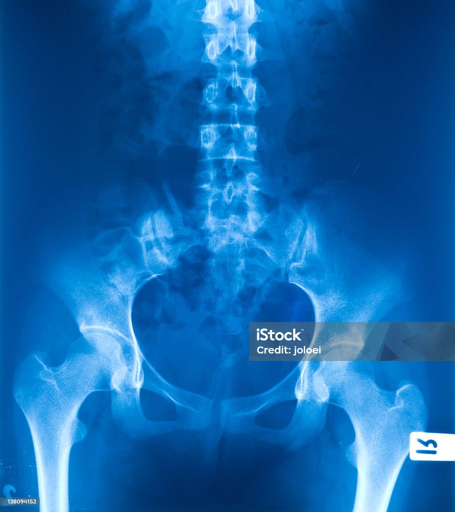 X-ray Folia z miednicy i kręgosłupa - Zbiór zdjęć royalty-free (Anatomia człowieka)