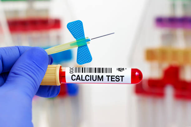 実験室でのカルシウム検査のための血液管および針を持つ医者 - ionized ストックフォトと画像