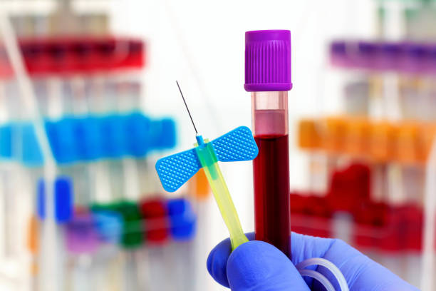 technician holding blood tube test and needle in the research laboratory - laboratory science healthcare and medicine centrifuge imagens e fotografias de stock