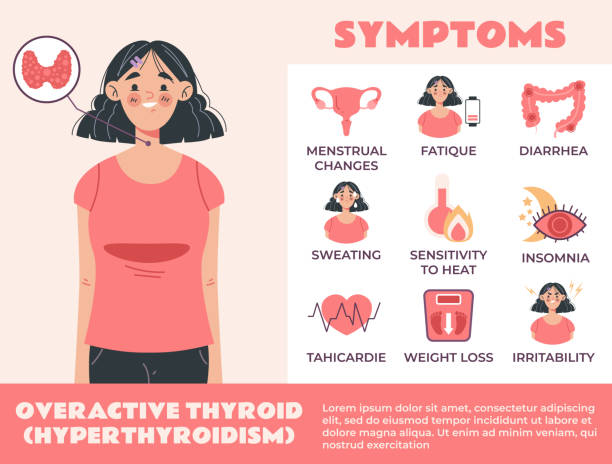 Hyperthyroidism infographic isolated concept. Vector flat graphic design cartoon illustration Hyperthyroidism infographic isolated concept. Vector flat graphic design illustration thyroid gland stock illustrations