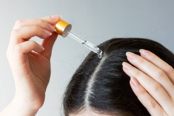 primo piano di una testa femminile con i capelli scuri. donna che usa la pipetta con un prodotto cosmetico vicino alla separazione dei capelli. il concetto di forfora - olio foto e immagini stock