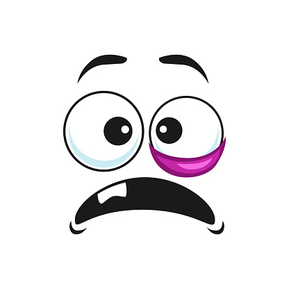Black eye emoticon with one tooth in open mouth isolated icon. Vector emoji showing eye swelling, mad face expression. Staring comic emoticon, amazed or curious funny smiley. Head with eyesight trauma