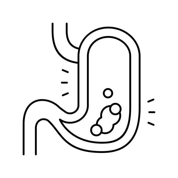 gastric disease line icon vector illustration gastric disease line icon vector. gastric disease sign. isolated contour symbol black illustration salivary gland surgery stock illustrations