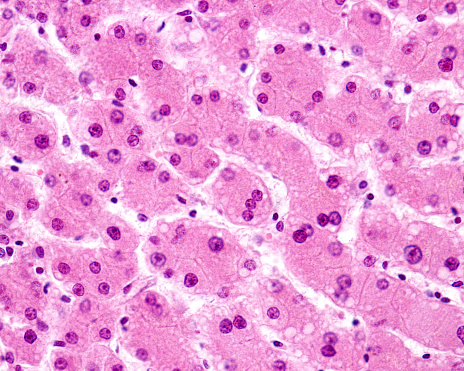 Human liver stained with H&E. Many of the hepatocytes show two nuclei or they have a very large nucleus. These cells are polyploid cells, with 4, 8 or more times the haploid chromosome complement. A hepatocyte with three nuclei can be seen in the center of the image.