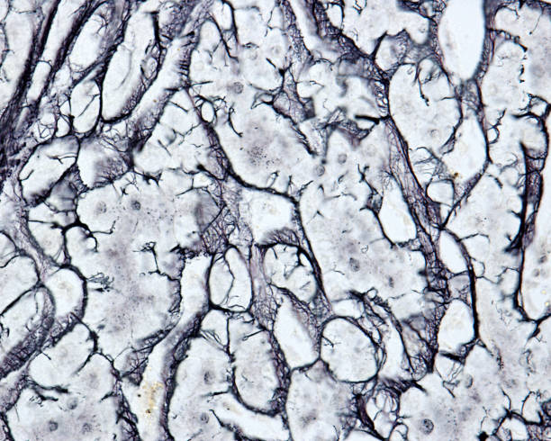 istock Human liver. Reticular fibers 1382281813