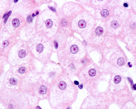 High magnification micrograph of liver cells or hepatocytes showing a large nucleolus stained with eosin.