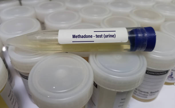 A urine drug test for Methadone drug test, also known as a Dolophine, urine drug screening painless test, A urine drug test for Methadone drug test, also known as a Dolophine, urine drug screening painless test, opioid medication methadone stock pictures, royalty-free photos & images