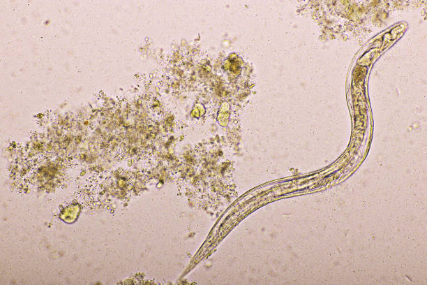 istock Strongyloides stercoralis or threadworm in human stool 1382357960