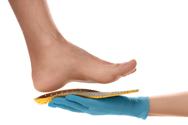 ortopeda montażu wkładka na stopę pacjenta na białym tle, zbliżenie - insoles orthotic human foot podiatry zdjęcia i obrazy z banku zdjęć