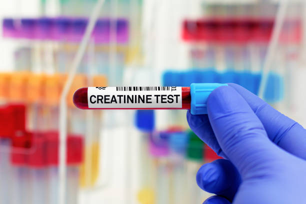 doctor with Blood tube for Creatinine test stock photo