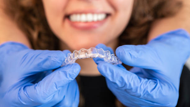 orthodontist doctor putting silicone invisible transparent braces on woman teeth - human teeth whitening dentist smiling imagens e fotografias de stock