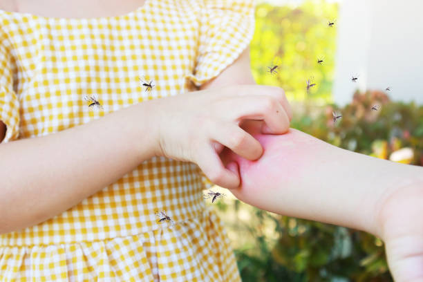 la petite fille a une allergie aux éruptions cutanées et des démangeaisons au bras dues à la piqûre de moustique - mosquito child bug bite scratching photos et images de collection