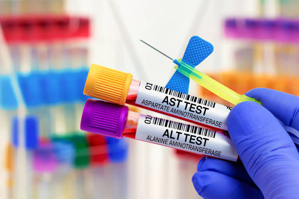 doctor with Blood tubes and needle for AST Aspartate aminotransferase and ALT alanine aminotransferase test in lab stock photo