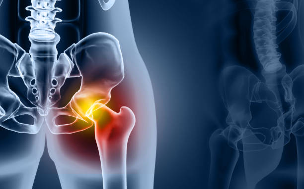 骨盤および股関節の骨、ヒト解剖学、大腿骨骨関節痛、股関節および大腿骨のx線。3d イラスト - arthritis osteoporosis pain backache ストックフォトと画像