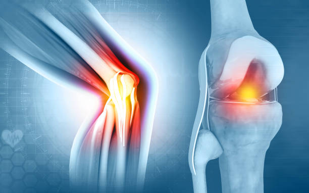Pain in knee joint. Tendon problems and Joint inflammation on dark background. 3d illustration Pain in knee joint. Tendon problems and Joint inflammation on dark background. 3d illustration human joint stock pictures, royalty-free photos & images