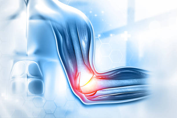 istock Pain in elbow. Damaged tendon tissue. 3d illustration 1383023120