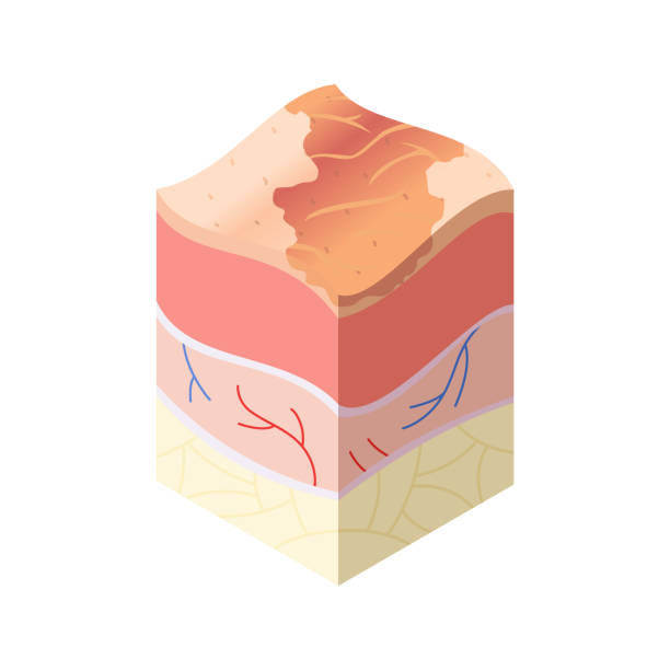 istock Skincare medical concept. Problems in cross-section of human skin horizontal layers structure. Anatomy illustrative model 1383107977