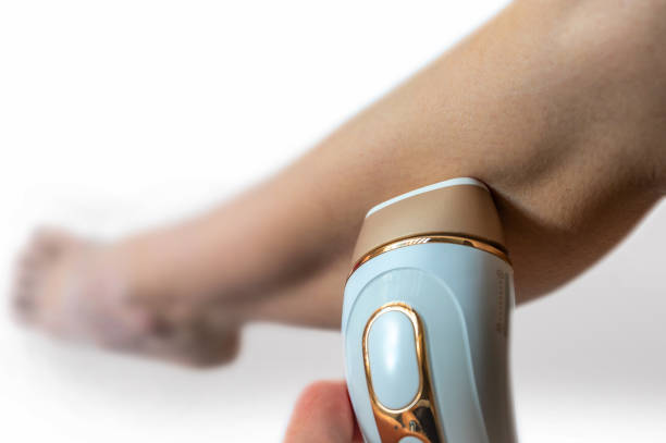gambe più belle grazie alla moderna depilazione con un dispositivo di depilazione - laser therapy medical laser light therapy foto e immagini stock