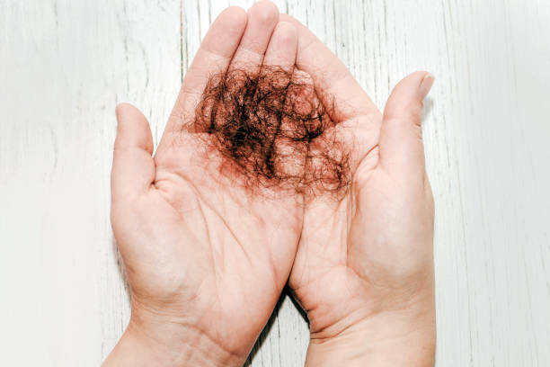 istock Bundle of fallen hair due to illness in the hands 1383471703