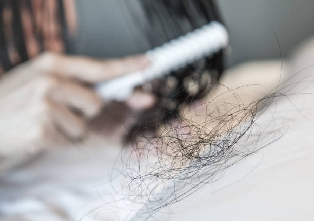 Hand of Female hold falling hair with black comb brush with long loss woman hair on white background for head healthcare problem with copyspace. Hair fall after combing in hairbrush. mano de mujer sostiene el cabello que cae con cepillo de peine negro con larga pérdida de pelo de mujer sobre fondo blanco para el problema de atención médica de la cabeza con el espacio de copia. el cabello se cae después de peinar en el cepillo de pe