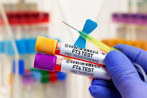 Blood sample for study of FT3 Free triiodothyronine and FT4 Free Thyroxine for Thyroid exam stock photo