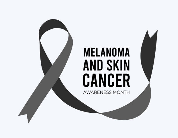 istock Melanoma and Skin Cancer Awareness Month. Vector illustration on white 1384260959